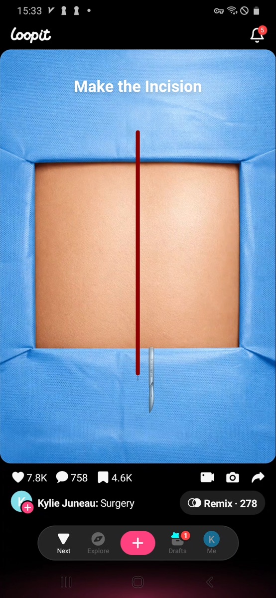 Loopit Surgery incision stage showing a completed red vertical cut.