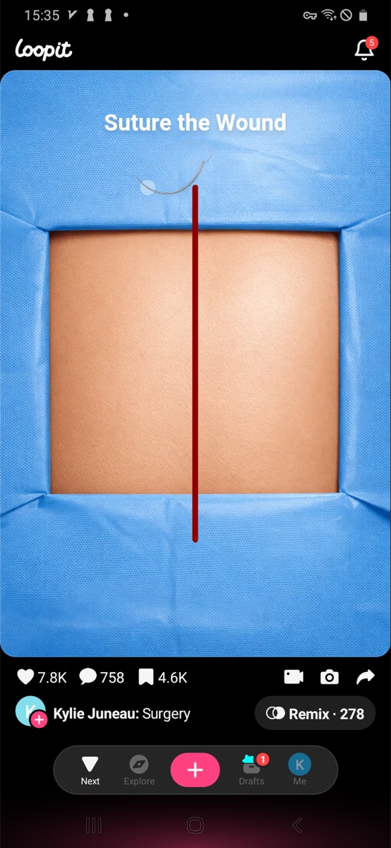 Loopit Surgery Suture the Wound stage with needle near the top of the red incision.